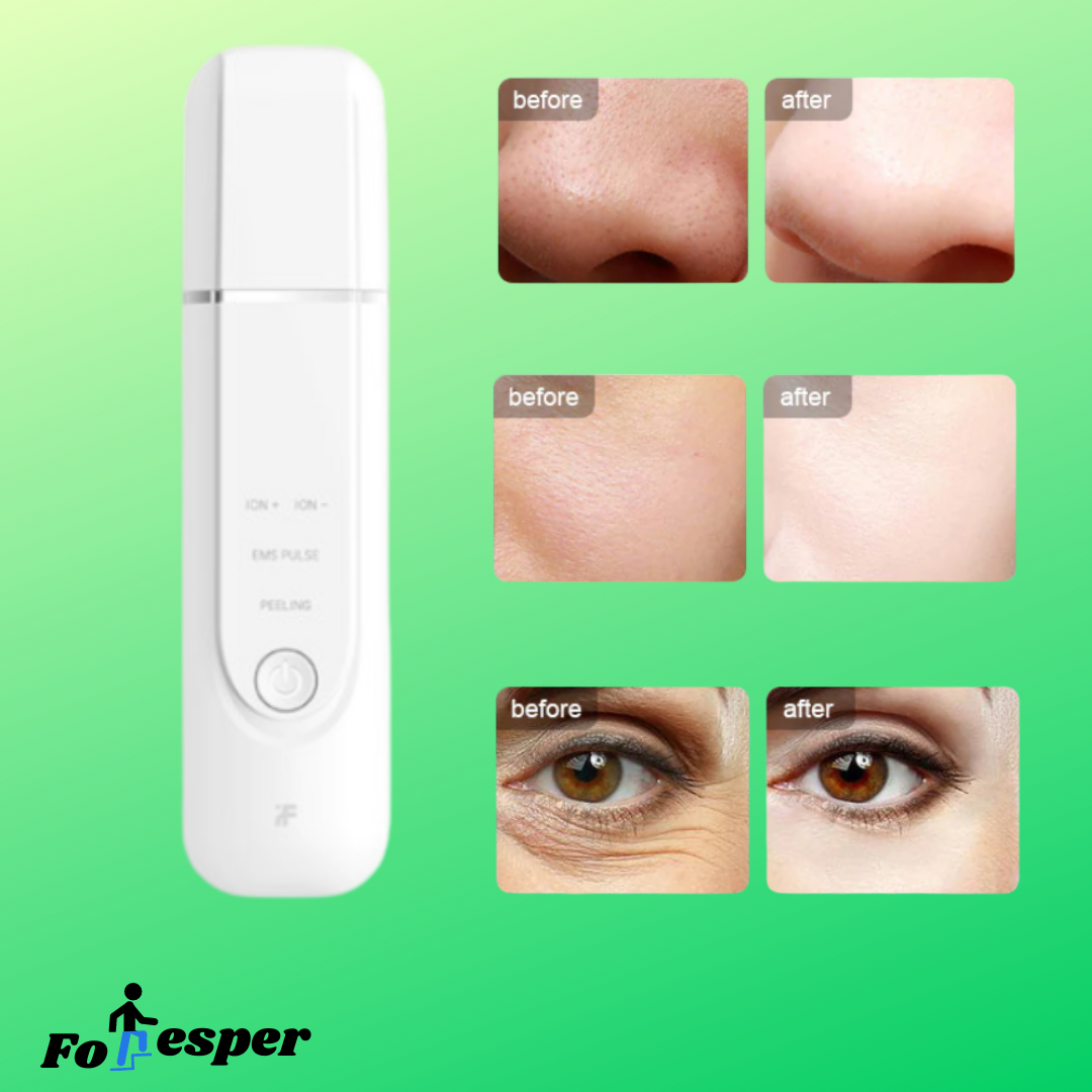 Máquina de iones ultrasónica limpieza de poros faciales de limpieza de espinillas