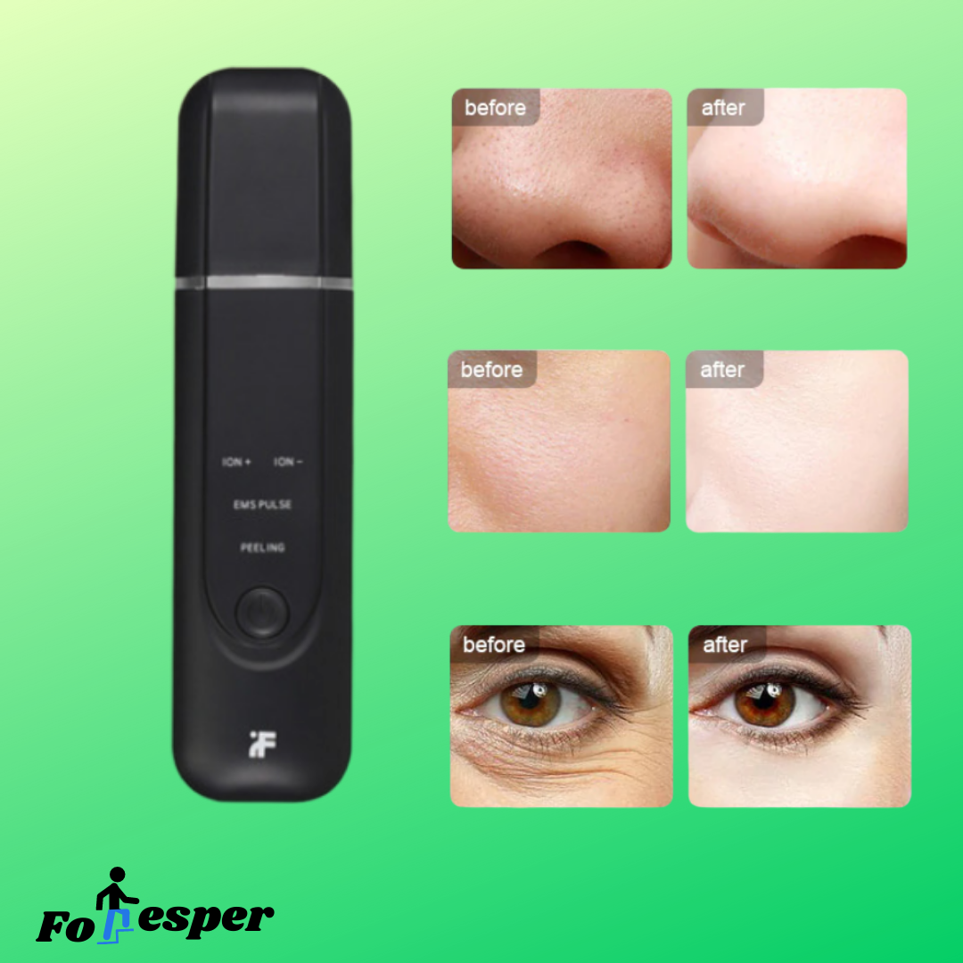 Máquina de iones ultrasónica limpieza de poros faciales de limpieza de espinillas