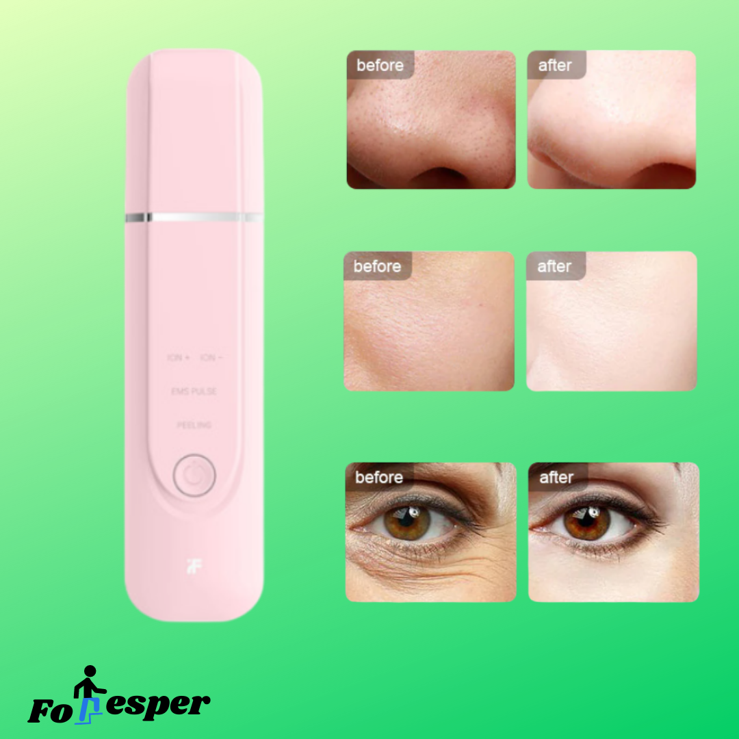 Máquina de iones ultrasónica limpieza de poros faciales de limpieza de espinillas