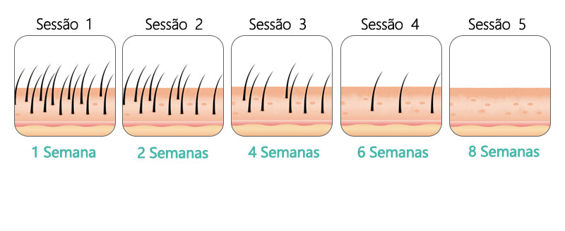 Laser depilador indolor, 600000 flash profissional