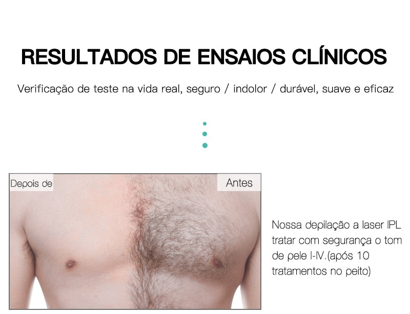 Laser depilador indolor, 600000 flash profissional