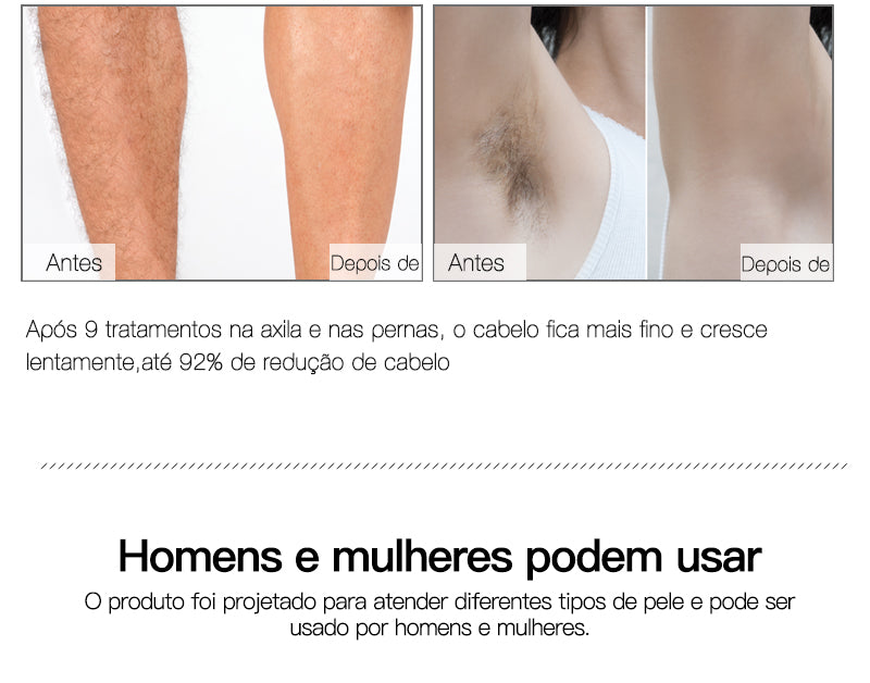Laser depilador indolor, 600000 flash profissional