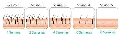 Laser depilador indolor, 600000 flash profissional