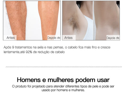 Laser depilador indolor, 600000 flash profissional